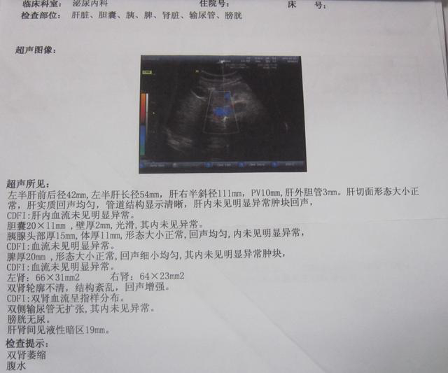 教你轻松看懂肝脏B超报告
