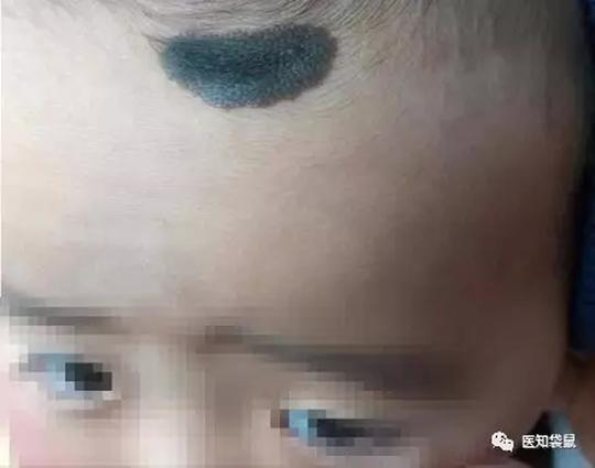 点击此处添加图注内容
