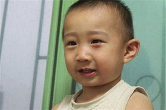 “眼瘸”这种病，80后是否还记忆犹新？