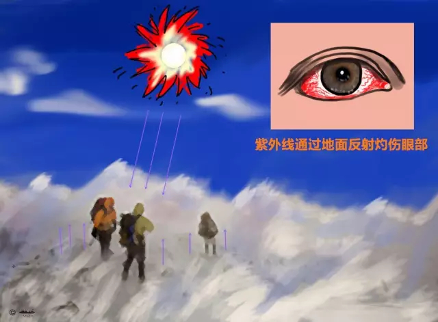 雪面对阳光的反射率接近100%，普通墨镜下部透光，无法有效防护。