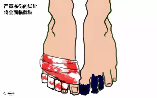 足部防护是高海拔攀登的重点。