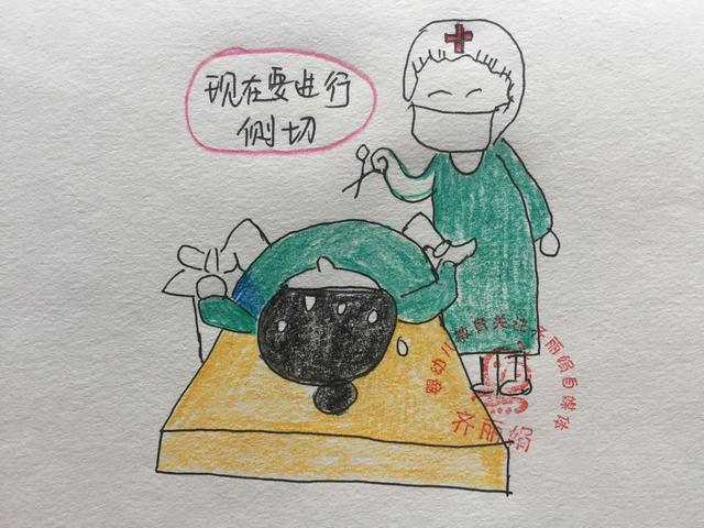 顺产为什么要侧切？宝妈亲身经历告诉你侧切那些事儿|顺产|产妇|医生|生孩子|伤口_新浪新闻