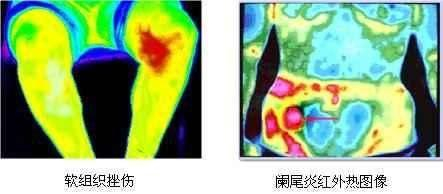 要脱光衣服的体检项目,但是却能筛查全身疾病!