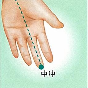 补益肝肾,中暑中风——手指上的穴位:中冲