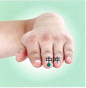 补益肝肾,中暑中风——手指上的穴位:中冲