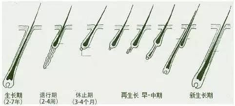 日本柳屋YANAGIYA药用生发液, 治疗脱发从改善头皮健康开始|脱发|柳屋|头皮_新浪新闻
