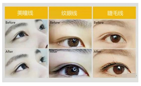 你知道眼线,睫毛线,美瞳线的区别吗?