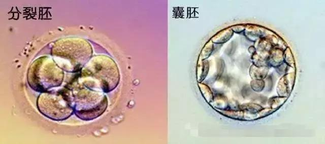 鲜胚?冻胚?囊胚?胚胎移植这些词都是什么意思?