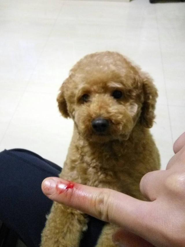 不小心被狗咬伤后,第一时间如何处理呢?!