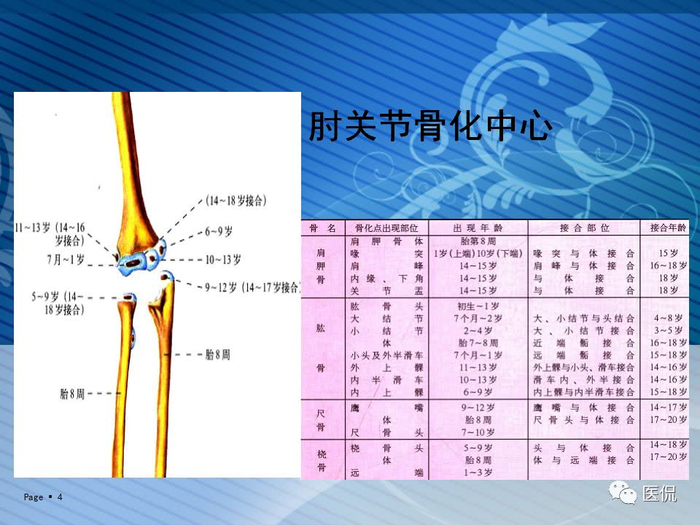 X光看未成年人上肢骨化中心的出现时间＃医学影像经典PPT|X光|未成年人|中心_新浪新闻