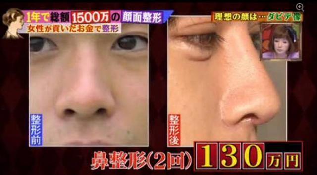 日本23岁小伙花1500万整容50次, 整容后变成了“蛇精男”