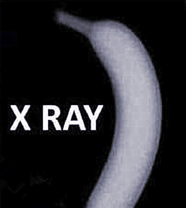 X光线、核磁共振和CT有啥区别看看这些仪器下的香蕉