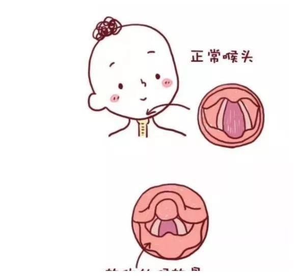 宝宝呛奶严重可危及生命？学会这几步，呛奶不再慌