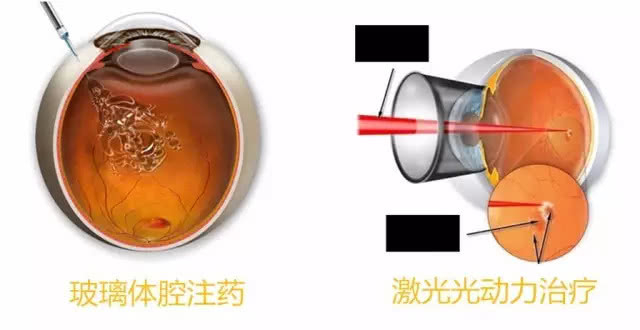 光动力医学
