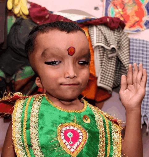印度先天畸形儿童被认为是神灵转世，每天都有村民前来朝拜！