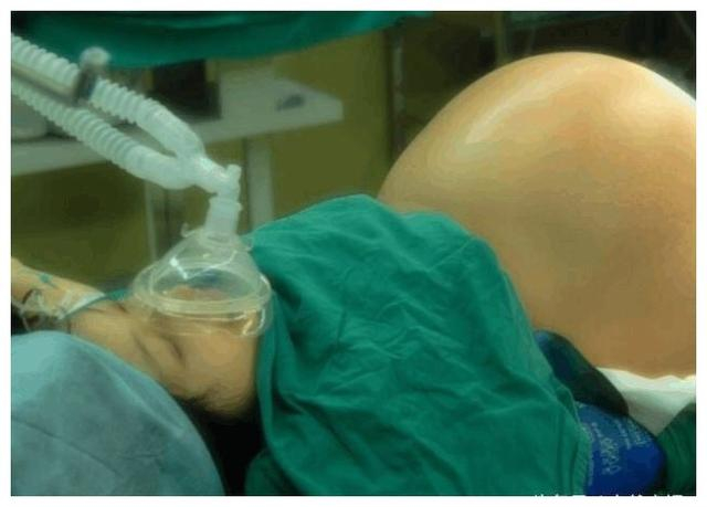 六胞胎要生医生护士紧张围一圈,还没准备好孩子就生完了!