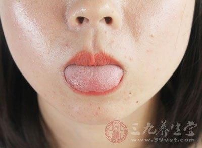 青紫舌一定就是癌症吗 舌头出现这些要注意!