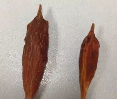 误吞了枣核咋办?协和医生都慌了!正确处理方式在这