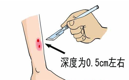 被蛇咬了怎么办？这有8个应急方法可自救，一定要知道。_新浪新闻