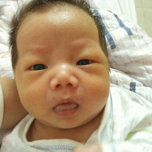 宝宝黄疸是正常还是疾病?教你一眼看出,特别第3种,宝妈要注意
