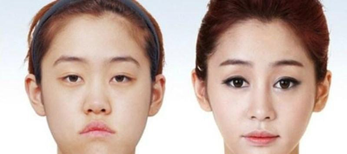 网红整容前后对比, 这些人造美女你怎么看?