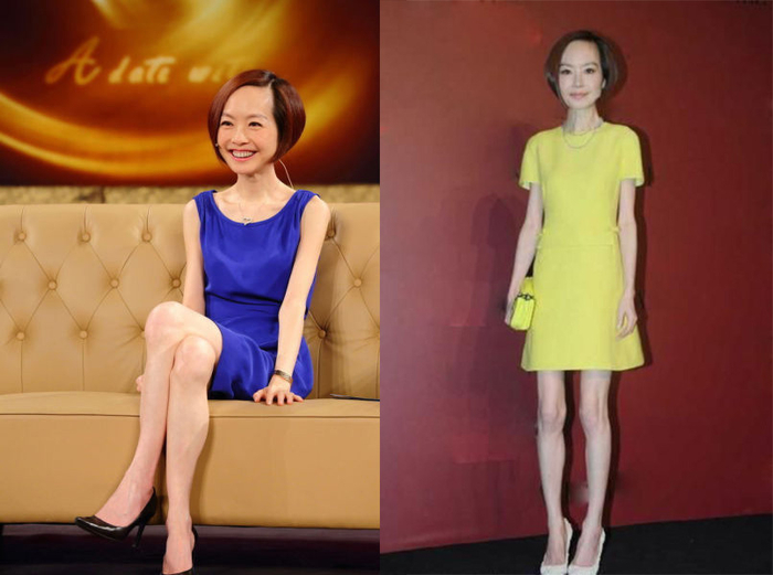 明星越瘦越美?舒淇瘦到连裤子也不合身了,而她瘦成“皮包骨”