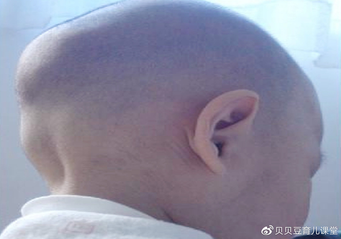“妈,为啥我是大扁头”毁颜值的事情别再干了,孩子长大后会埋怨