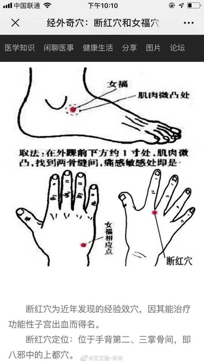 女福穴止痛效果强，十分钟内解除产妇宫缩痛，极其效验