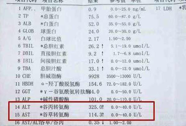 转氨酶升高，是不是你的肝脏被侵犯了？2植物搭配，降酶保肝