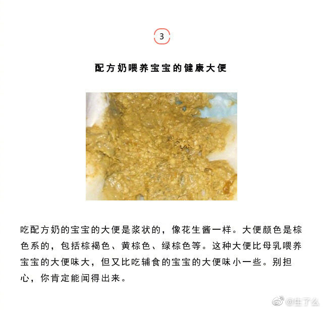 宝宝大便图解（有图有真相）， 请做好心理准备再看，可能会引起不适