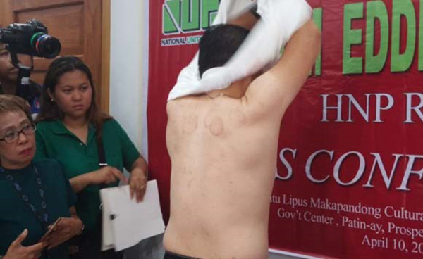 　　杜特尔特总统强力支持的参议员候选人克里斯多夫·蒙·吴多次在公开场合脱衣服展示自己后背没有所谓的毒品集团纹身。 图片来源：https：//politics.com.ph/