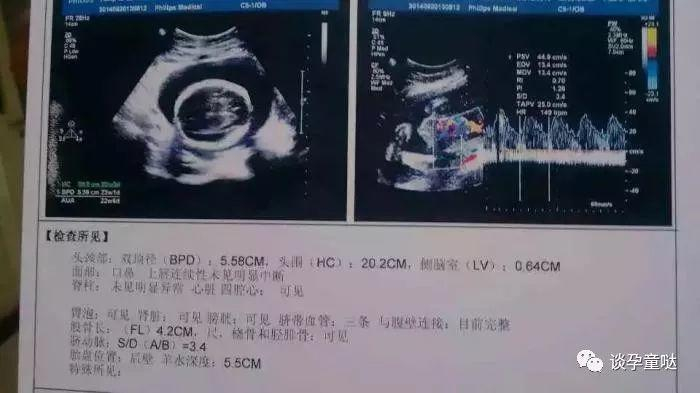 看B超识别胎儿性别, 几个小方法教你看穿B超秘密|男孩_新浪新闻