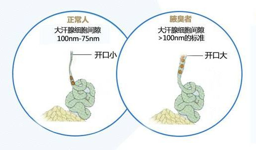 狐臭克星！喷一喷靶向除臭，拒做人体“毒气弹”！|汗腺|腋臭|枯萎|气味|保密性_新浪新闻