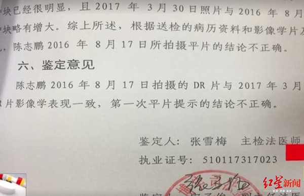 司法鉴定结果