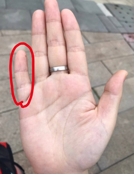 在手相中小拇指代表下属,子女,晚辈的运势.