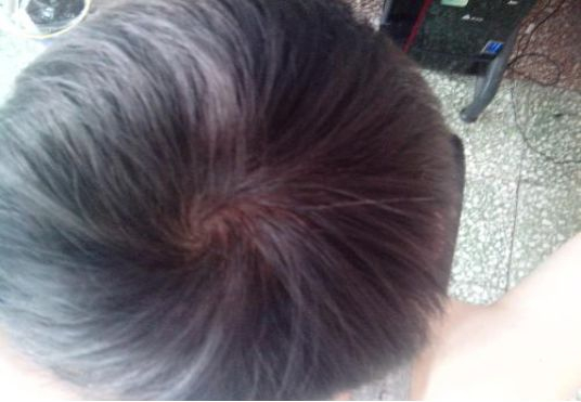 头顶上的发旋代表了什么？为什么有人一个，有人两三个？涨知识了