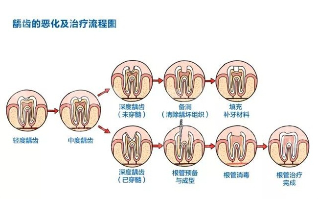 让你秒懂牙科,分分钟解锁牙齿新姿势