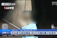 花40元做个美容 竟弄坏了5万元隆的鼻子