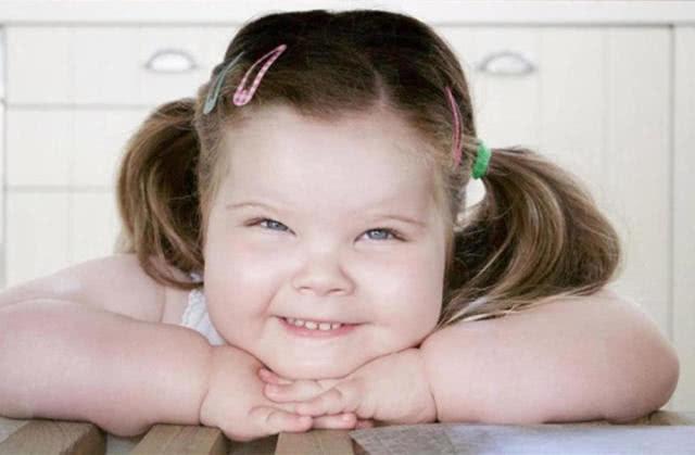 小女孩患罕见病4岁体重就超过8岁孩子, 并且无法阻止发胖