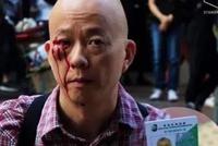 “人超好”的港籍台媒记者 也被暴徒殴打了(图)