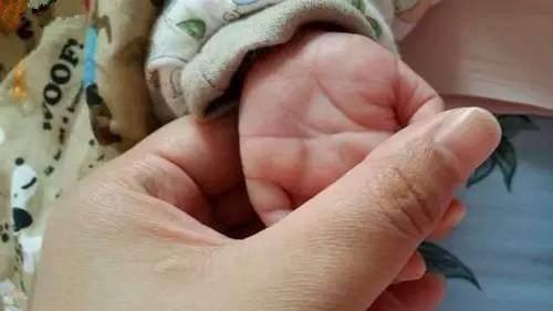 8个月大男婴紧握拳头，奶奶发现不对劲带娃去看病，医生：来太晚