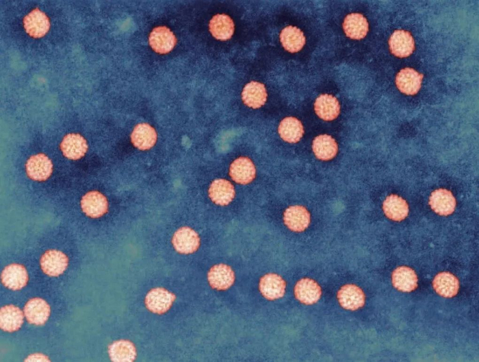 溶液中悬浮的人乳头瘤病毒