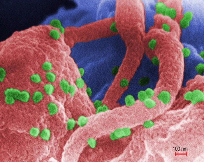 附着在CD4细胞表面的人类免疫缺陷病毒（HIV）