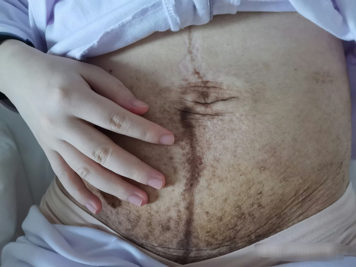 研究称怀孕或致女性衰老超5岁