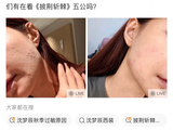 沈梦辰回应脸上过敏 披荆斩棘公演舞台状态稳