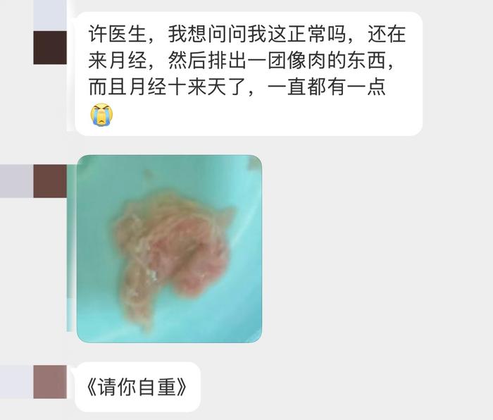 经期排出肉团且持续十余天，医生建议验孕并就医