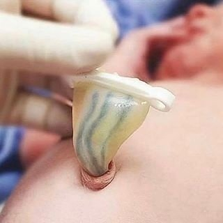 脐带结构揭秘，内含一静脉两动脉