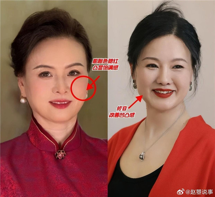 中年女性发腮反显年轻,苦相脸更显老态|苦相|五官|眉眼