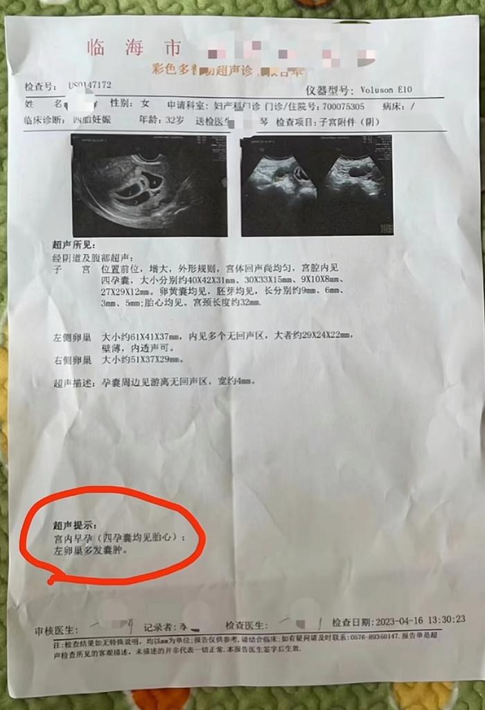 四胞胎妈妈再怀四胞胎！剖腹四宝才9个半月，网友：生了个篮球队