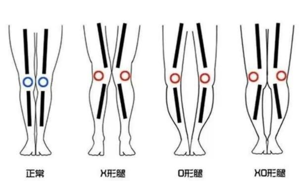 秋冬穿靴子，选长靴还是短靴，解析你的“腿型条件”，穿得更合适